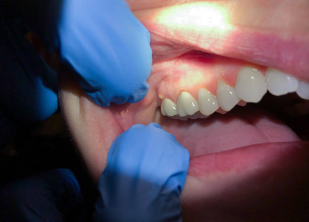 Best Emergency Root Canal Therapy in Tupelo, MS