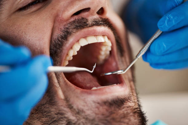 Best Emergency Cosmetic Dentistry (e.g., broken veneers) in Tupelo, MS